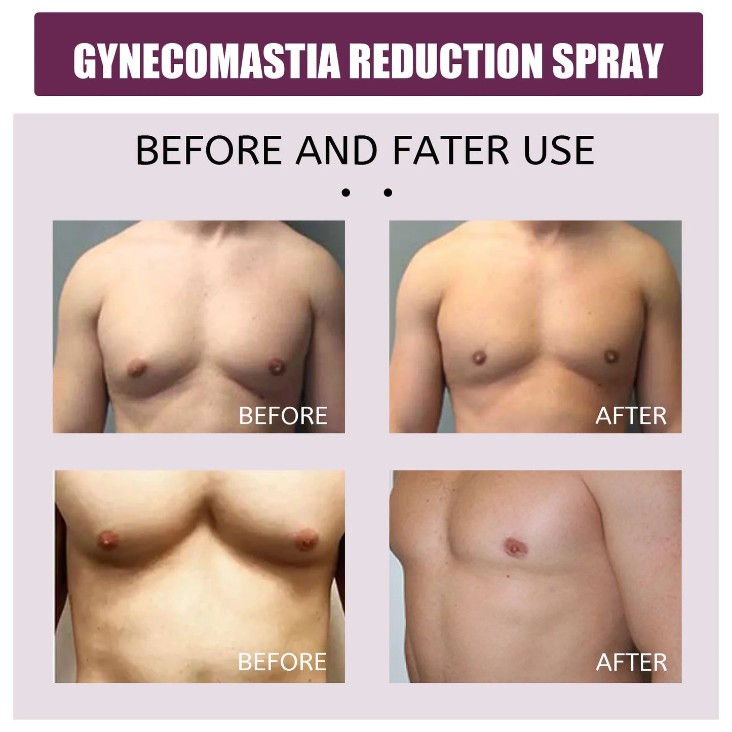 Gynecomastia removal spray